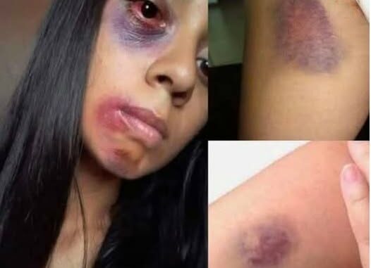 Young woman dies at the hands of her…See more